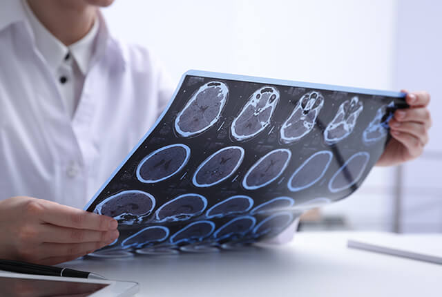 脳のMRI画像を確認している医師